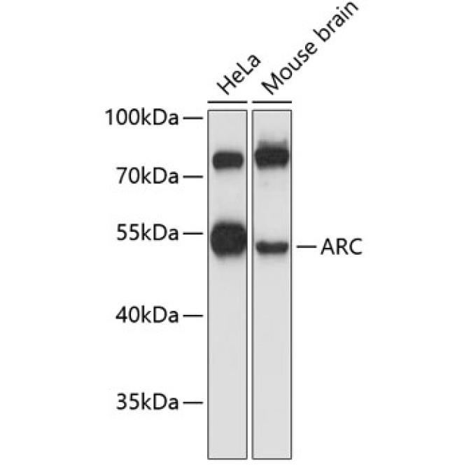 ARC Rabbit Polyclonal Antibody
