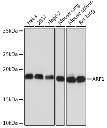 ARF1 Rabbit Monoclonal Antibody