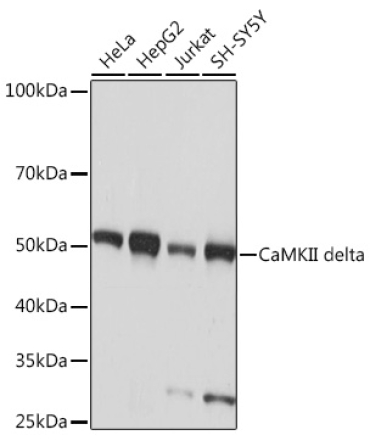 CaMKII delta Rabbit Monoclonal Antibody