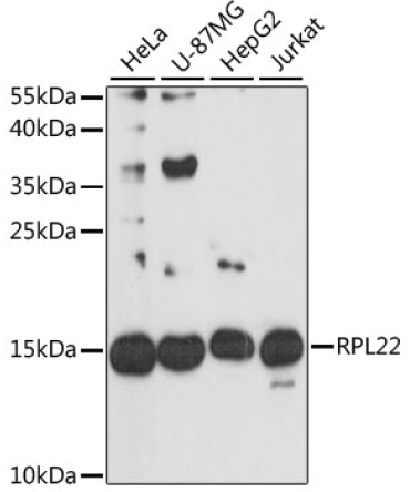 RPL22 Rabbit Polyclonal Antibody [KO Validated]