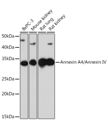 Annexin A4/Annexin IV Rabbit Monoclonal Antibody