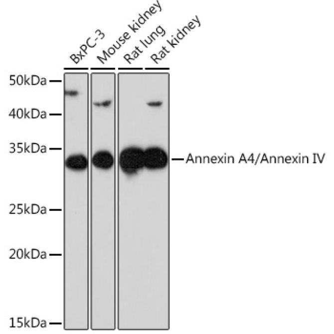 Annexin A4/Annexin IV Rabbit Monoclonal Antibody