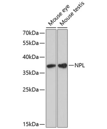 NPL Rabbit Polyclonal Antibody