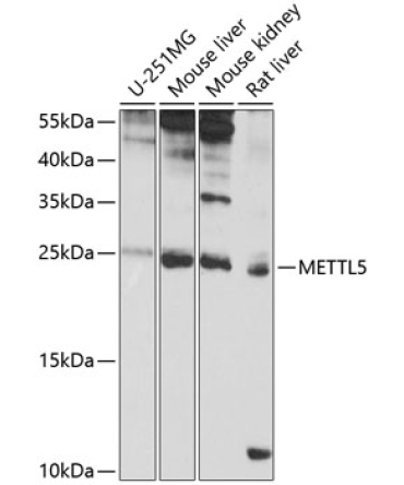 METTL5 Rabbit Polyclonal Antibody
