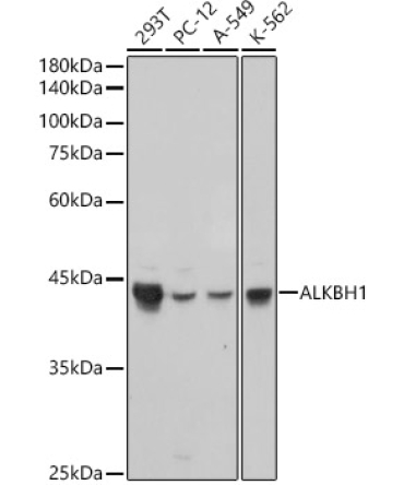 ALKBH1 Rabbit Monoclonal Antibody