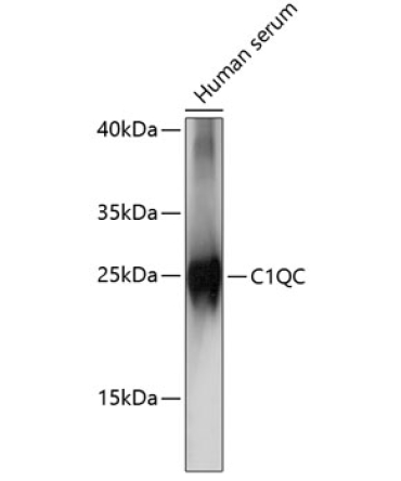 C1QC Rabbit Polyclonal Antibody