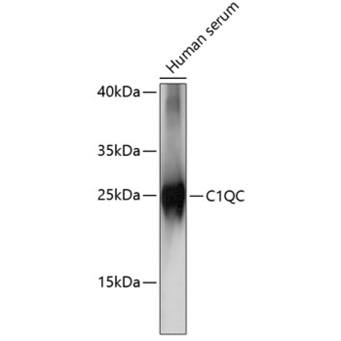 C1QC Rabbit Polyclonal Antibody