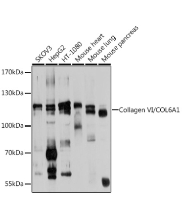 Collagen VI/COL6A1 Rabbit Polyclonal Antibody