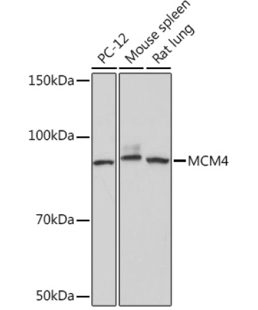 MCM4 Rabbit Monoclonal Antibody