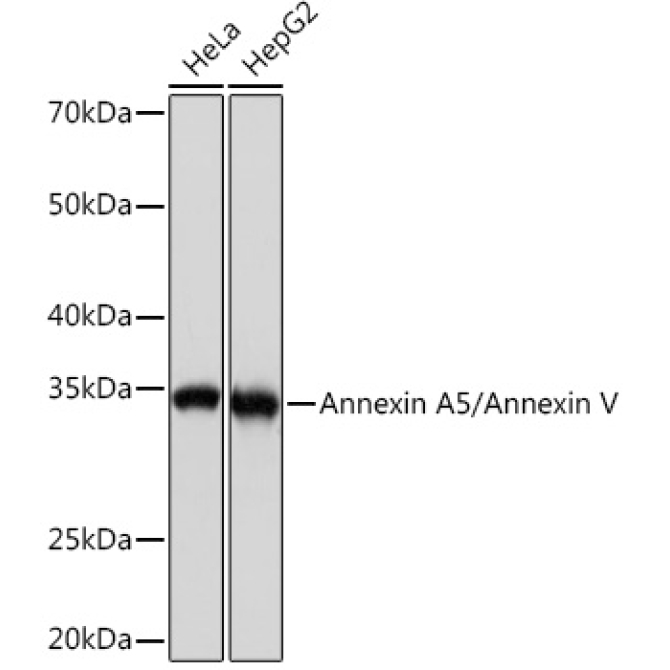 Annexin A5/Annexin V Rabbit Monoclonal Antibody