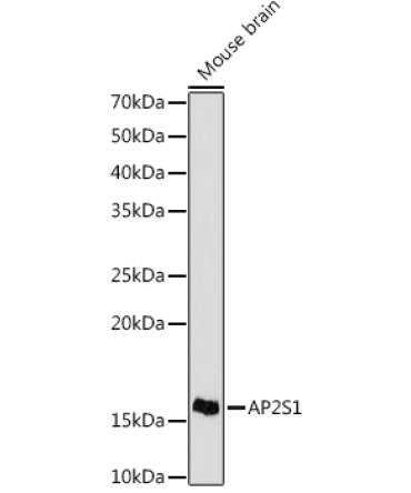 AP2S1 Rabbit Monoclonal Antibody