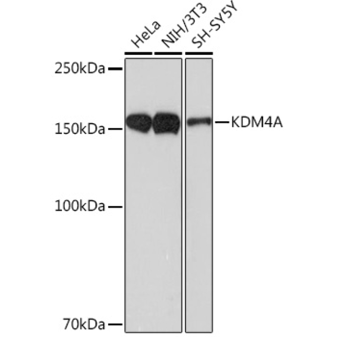 KDM4A Rabbit Monoclonal Antibody