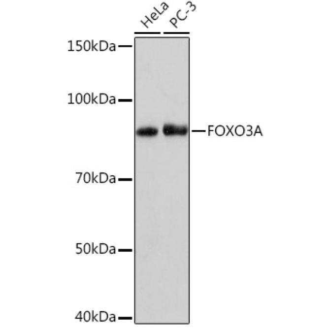 FOXO3A Rabbit Monoclonal Antibody
