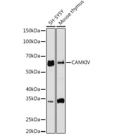 CAMKIV Rabbit Monoclonal Antibody