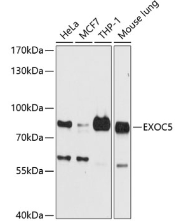 EXOC5 Rabbit Polyclonal Antibody