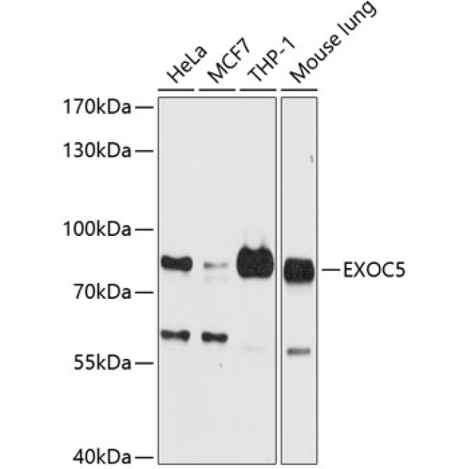 EXOC5 Rabbit Polyclonal Antibody