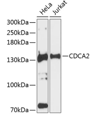 CDCA2 Rabbit Polyclonal Antibody