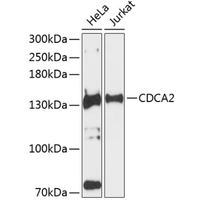 CDCA2 Rabbit Polyclonal Antibody