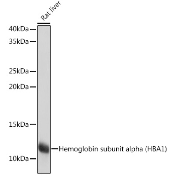 Hemoglobin subunit alpha (HBA1) Rabbit Monoclonal Antibody