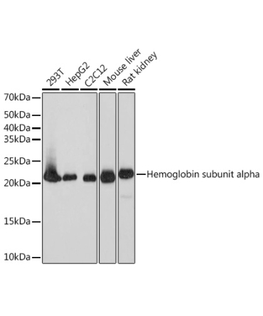 DHFR Rabbit Monoclonal Antibody