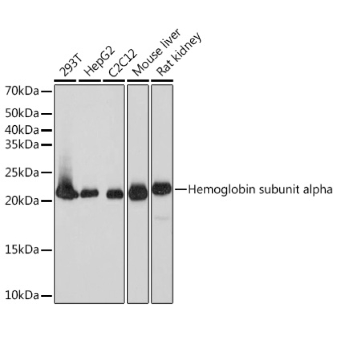 DHFR Rabbit Monoclonal Antibody
