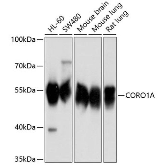 CORO1A Rabbit Polyclonal Antibody