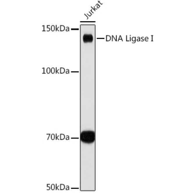 DNA Ligase I Rabbit Monoclonal Antibody