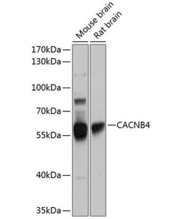 CACNB4 Rabbit Polyclonal Antibody