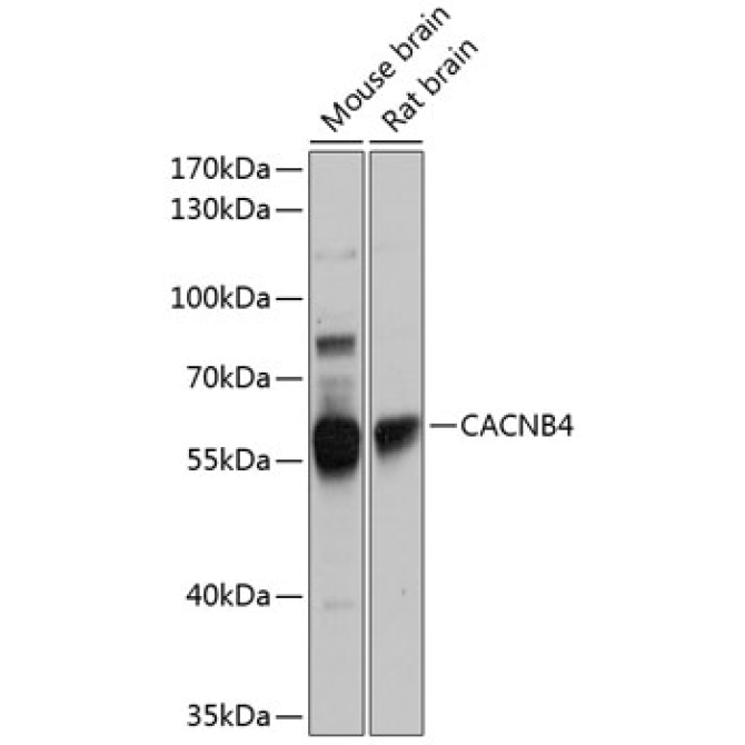 CACNB4 Rabbit Polyclonal Antibody