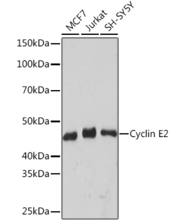 Cyclin E2 Rabbit Monoclonal Antibody