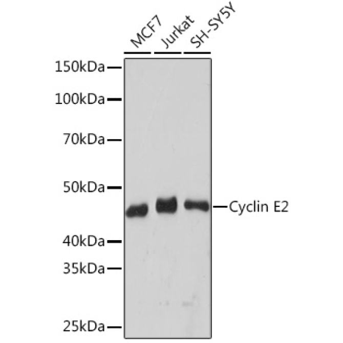Cyclin E2 Rabbit Monoclonal Antibody