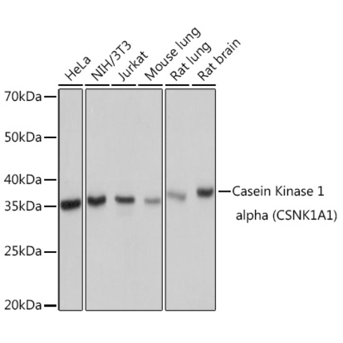 Casein Kinase 1 alpha (CSNK1A1) Rabbit Monoclonal Antibody