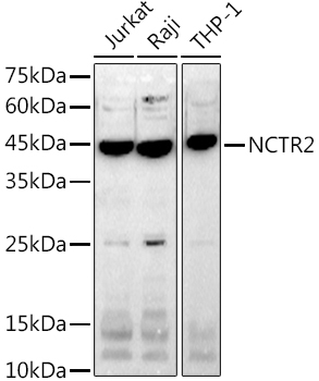 NCTR2 Rabbit Monoclonal Antibody