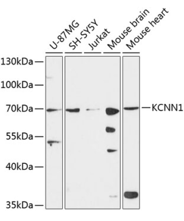 KCNN1 Rabbit Polyclonal Antibody