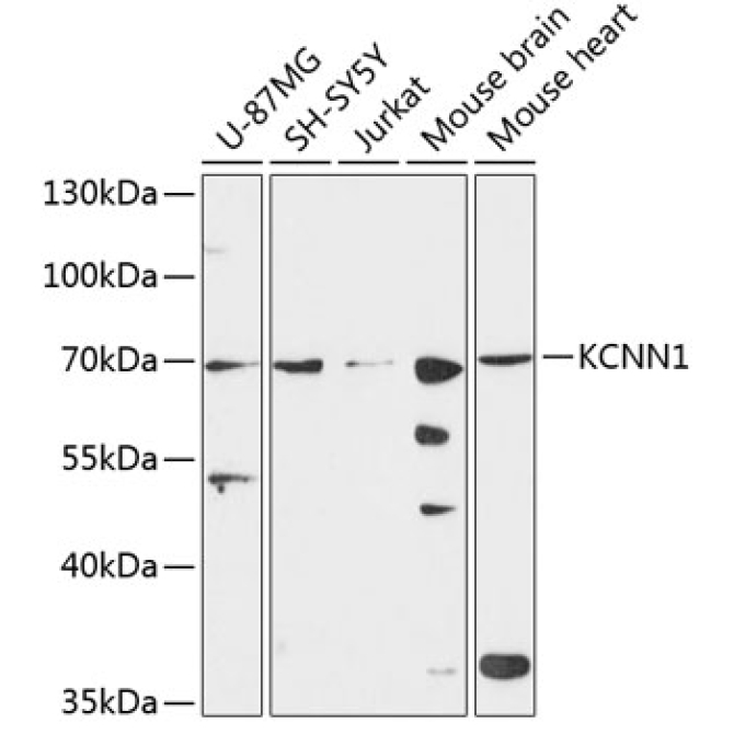 KCNN1 Rabbit Polyclonal Antibody