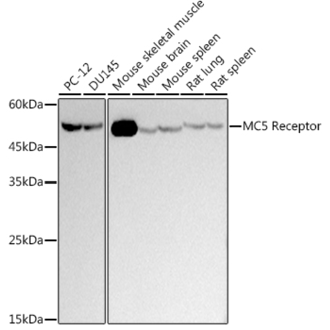 MC5 Receptor Rabbit Monoclonal Antibody