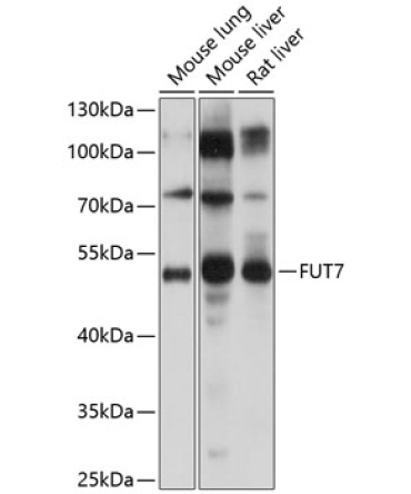 FUT7 Rabbit Polyclonal Antibody