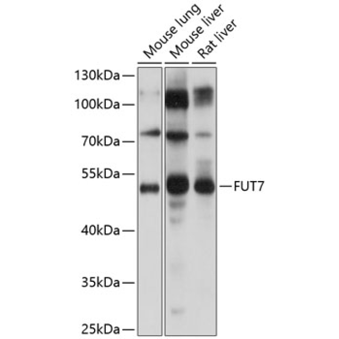 FUT7 Rabbit Polyclonal Antibody