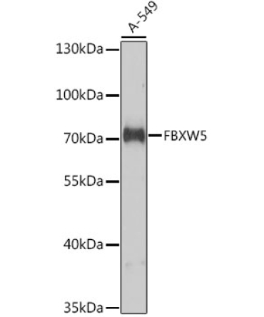 FBXW5 Rabbit Polyclonal Antibody