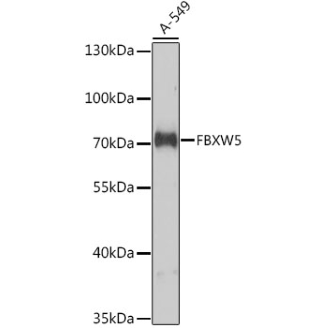 FBXW5 Rabbit Polyclonal Antibody
