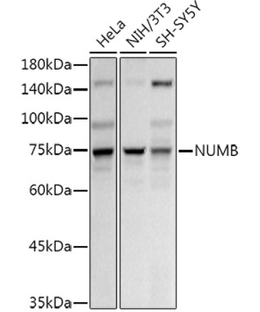 NUMB Rabbit Polyclonal Antibody