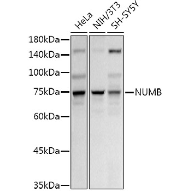 NUMB Rabbit Polyclonal Antibody
