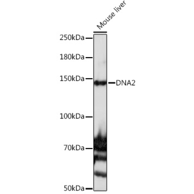 DNA2 Rabbit Polyclonal Antibody