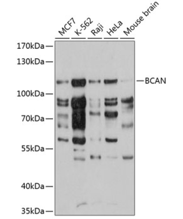 BCAN Rabbit Polyclonal Antibody