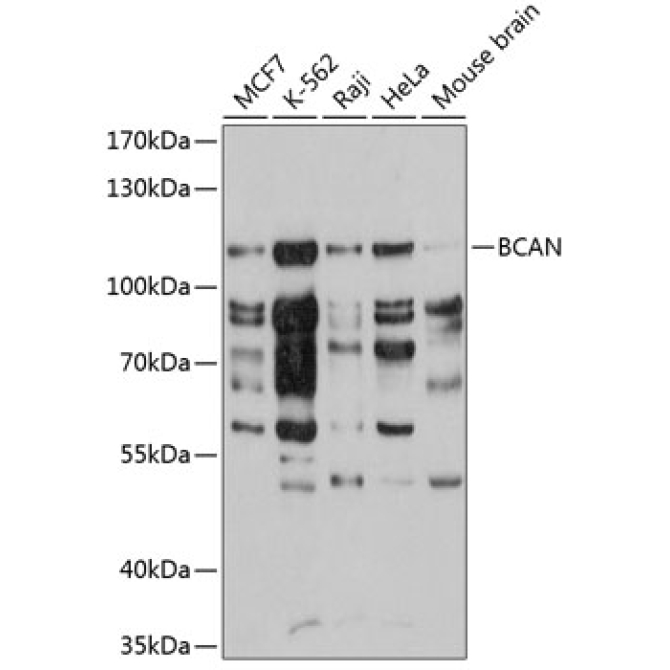 BCAN Rabbit Polyclonal Antibody