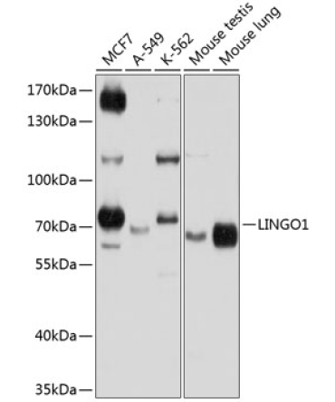 LINGO1 Rabbit Polyclonal Antibody