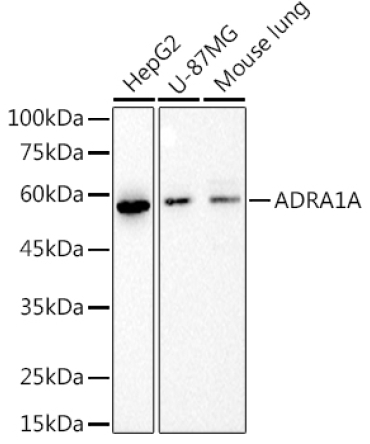 ADRA1A Rabbit Monoclonal Antibody