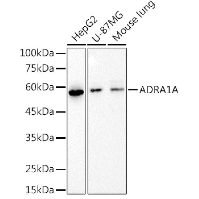ADRA1A Rabbit Monoclonal Antibody