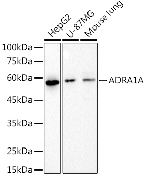 ADRA1A Rabbit Monoclonal Antibody