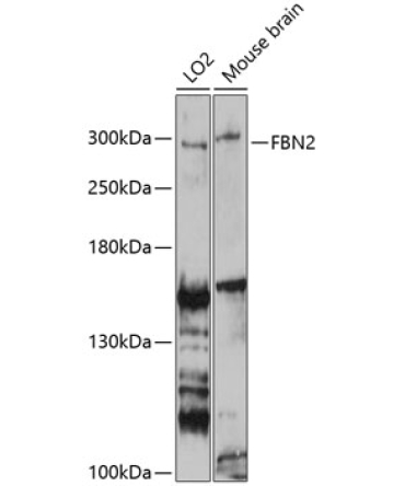 FBN2 Rabbit Polyclonal Antibody